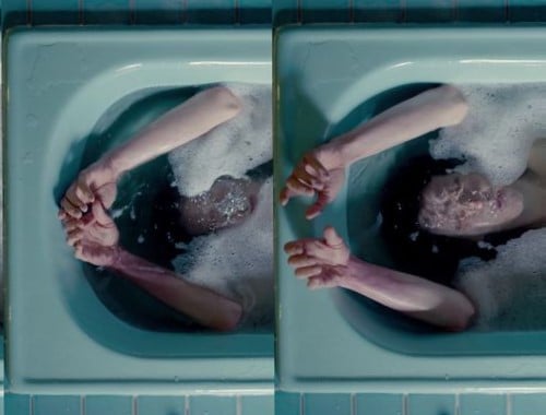 Disforia Pós-Coital