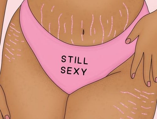 Vergonha do meu corpo