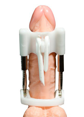 Extensor Peniano - Tensor-Din Light | Disponível em 2 Cores - 3