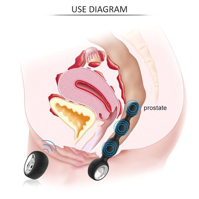 Plug Anal Vibratório Escalonado em Silicone com 12 Modos de Vibração e Controle Remoto - Pleasure Dreams | 17 x 3,5 - 3