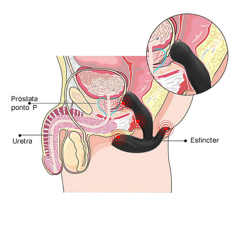Estimulador de Próstata e Períneo Recarregável em Silicone com 9 Modos de Vibração e Controle Remoto Sem Fio - S-Hande Megatron-RCT | 9,2 x 3 cm - 4